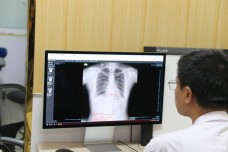 AI - 'con mắt thứ ba' giúp bác sĩ phát hiện sớm ung thư từ dấu hiệu nhỏ