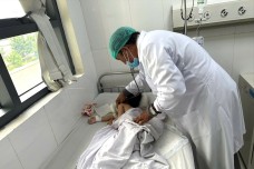 Cháu bé 4 tuổi tắc ruột vì bị hội chứng ‘công chúa tóc mây’