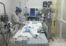 Gần 100 ngày chạy đua với 'tử thần' cứu sống bé trai bị cha phóng hỏa sau ly hôn