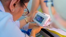 Bệnh viện đầu tiên tại Việt Nam tầm soát ung thư cổ tử cung bằng trí tuệ nhân tạo