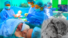 Bác sĩ 'vá' mạch máu trong bụng mẹ, cứu thai nhi mắc khối u khổng lồ