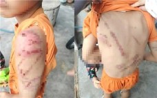 Diễn biến mới vụ bé trai chi chít vết thương ở Đắk Lắk