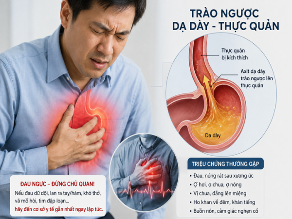 Đau ngực tưởng mắc bệnh tim, bác sĩ phát hiện 'thủ phạm' từ dạ dày