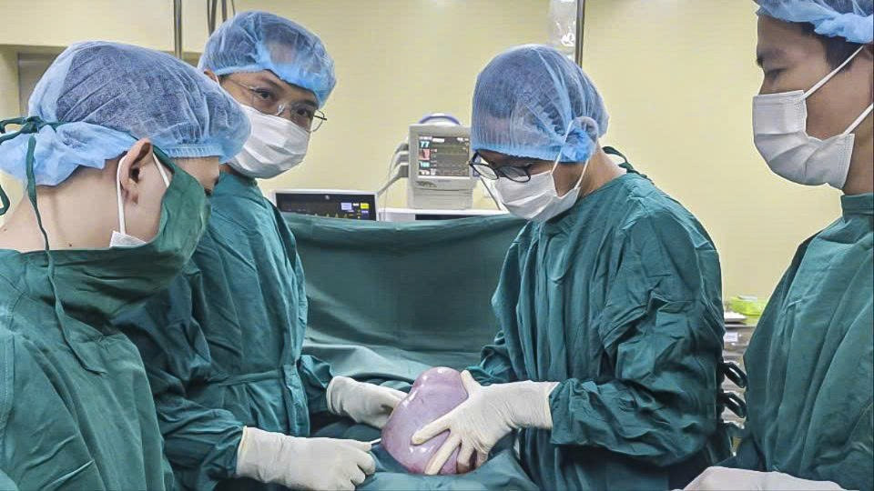 Khối u buồng trứng “khổng lồ” nặng 5,5 kg, được các bác sĩ phẫu thuật thành công. a5457deb4dedc7b39efc.jpg