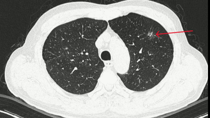 AI được ví như 