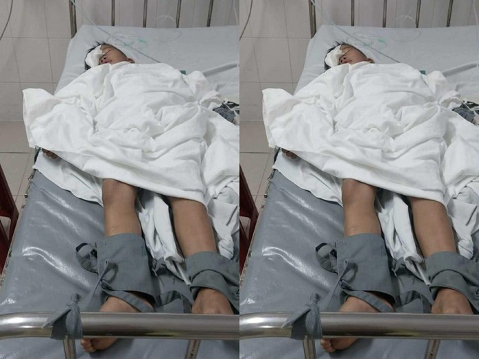 Phụ huynh tố cáo con lớp 1 bị bạn chọc mắt gây thương tích nghiêm trọng - Ảnh 1.